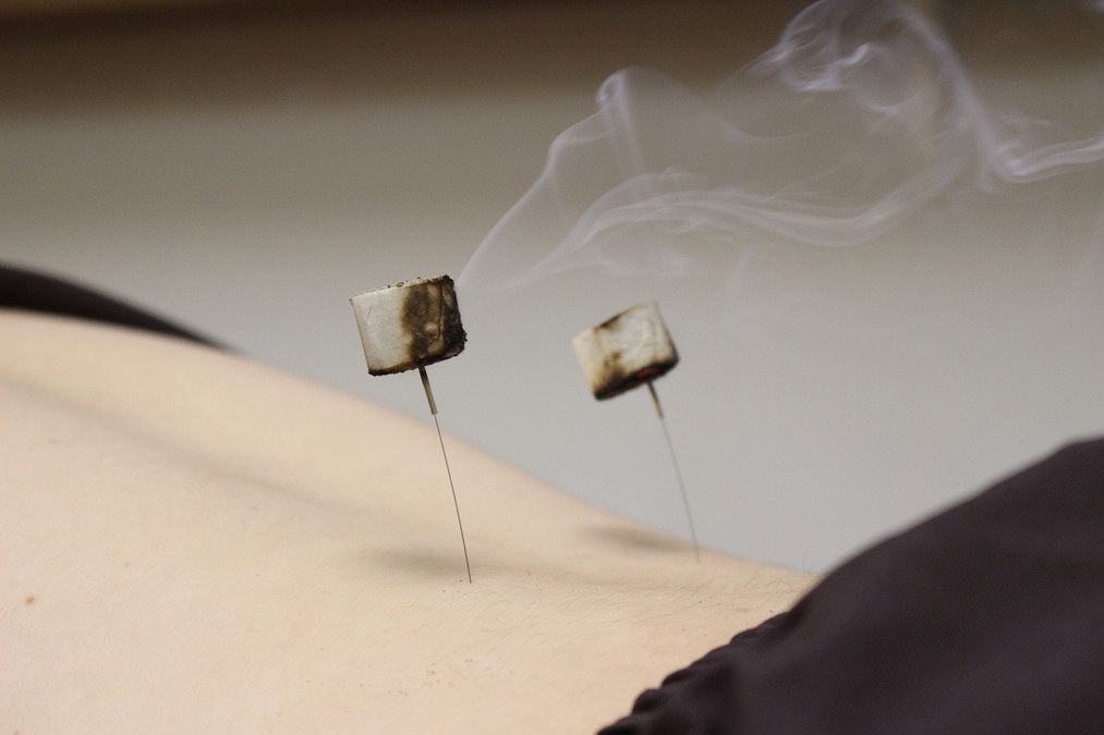 正社員 鍼灸師 接骨院・整骨院 鍼灸整骨院 鍼灸院・鍼灸サロンの求人情報イメージ1