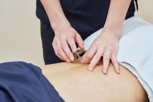 リーフの正社員 鍼灸師 接骨院・整骨院 鍼灸整骨院求人イメージ