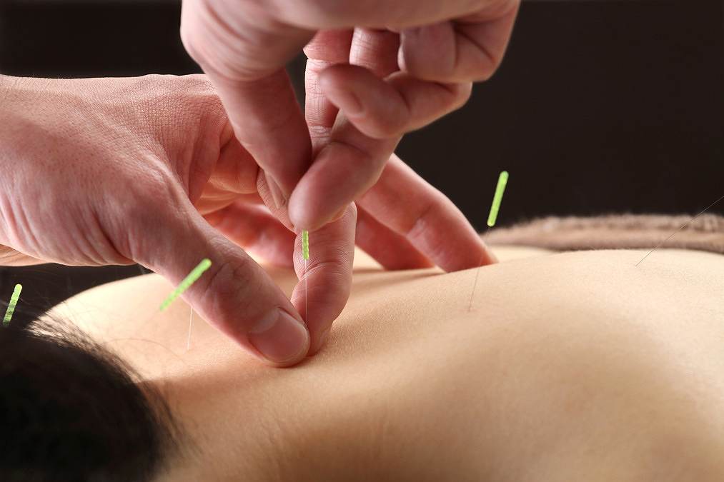 プロフェッショナルメディックの正社員 鍼灸師 接骨院・整骨院 鍼灸整骨院求人イメージ