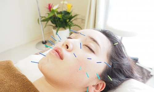 正社員 鍼灸師 鍼灸院・鍼灸サロンの求人情報イメージ1